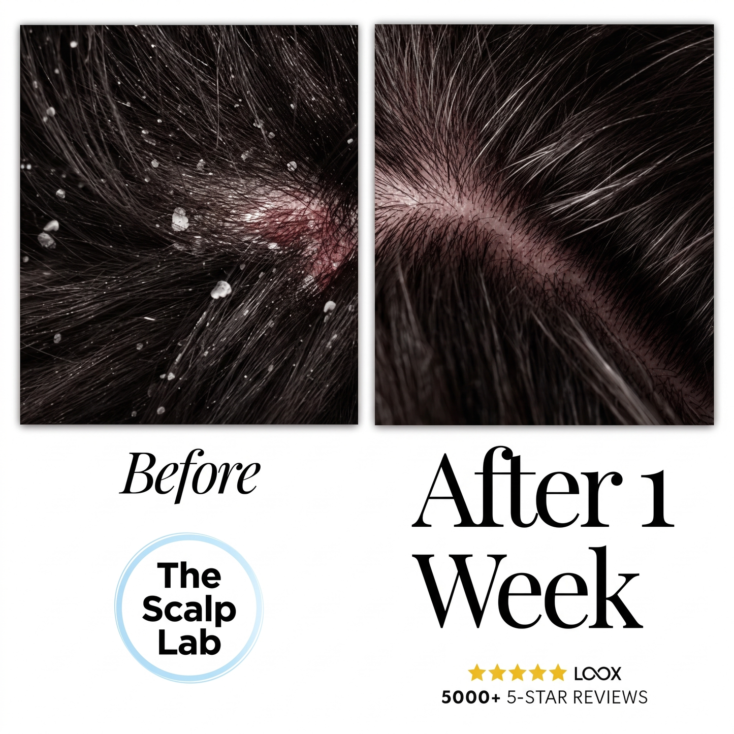Anti-Dandruff Serum