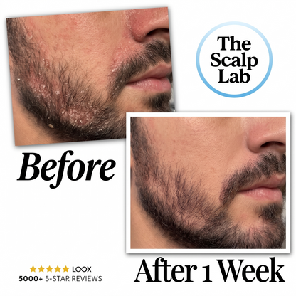Anti-Dandruff Serum