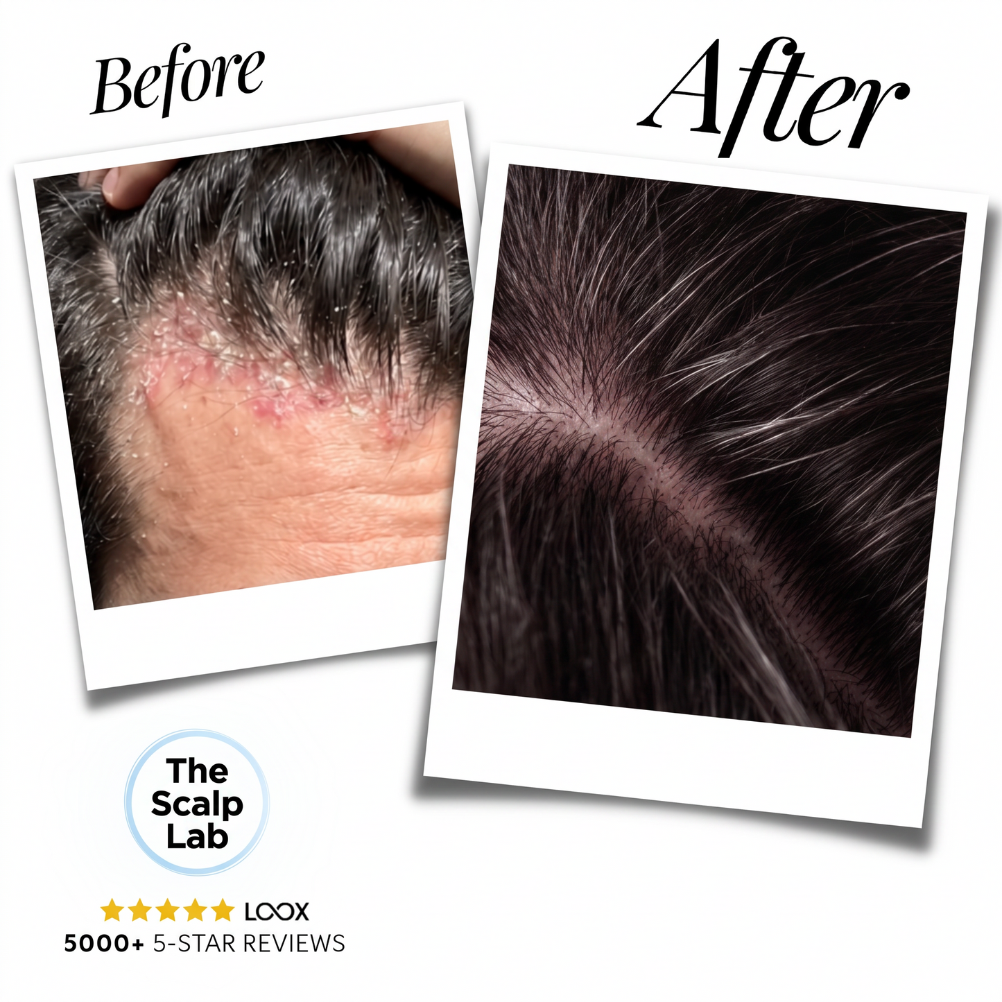 Anti-Dandruff Serum