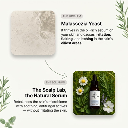 Anti-Dandruff Serum